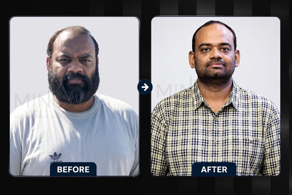 Minus-Before-and-afterArtboard-1.jpg.jpeg