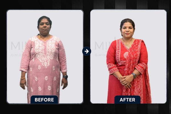 Minus-Before-and-afterArtboard-2.jpg.jpeg