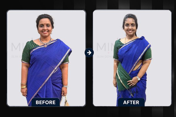Minus-Before-and-afterArtboard-4.jpg.jpeg