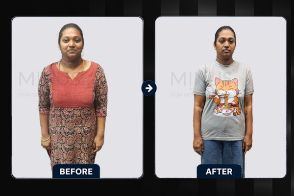 Minus-Before-and-afterArtboard-5-copy.jpg.jpeg