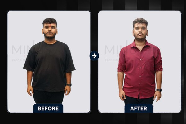 Minus-Before-and-afterArtboard-5.jpg.jpeg